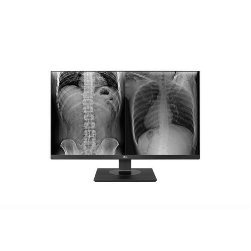 LG 27HJ713C-B 27" (16:9) UHD IPS LED MONITOR, 3840x2160, 14MS, HDMI(2), DP, sRGB-99 , DICOM, H/ADJ, TILT